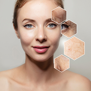 Anti Ageing treatment in hyderabad